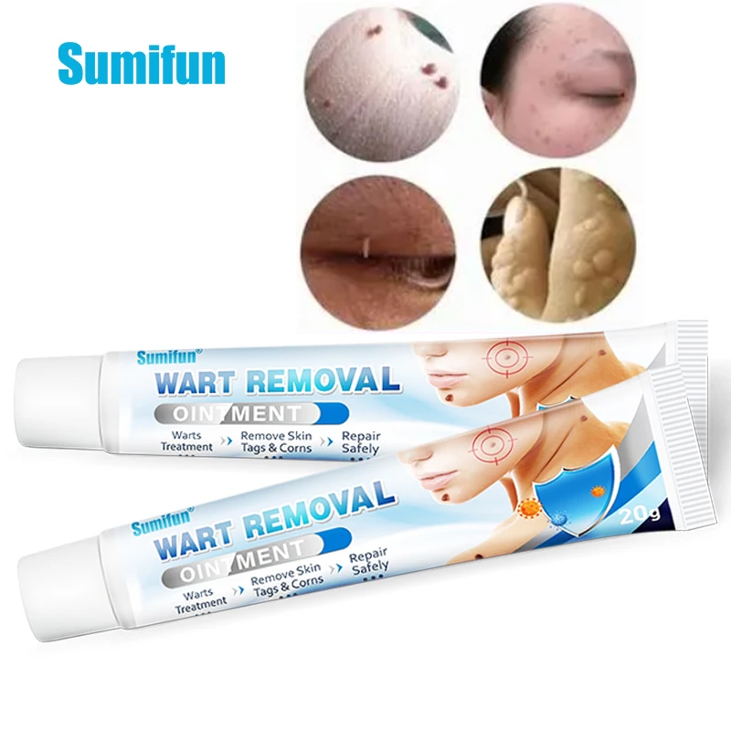

Sumifun 20g Wart Remover Wart Removal Liquid Wart Mole Skin Tags Corn Genital Wart Remover Cream Remove Warts Medical Plaster