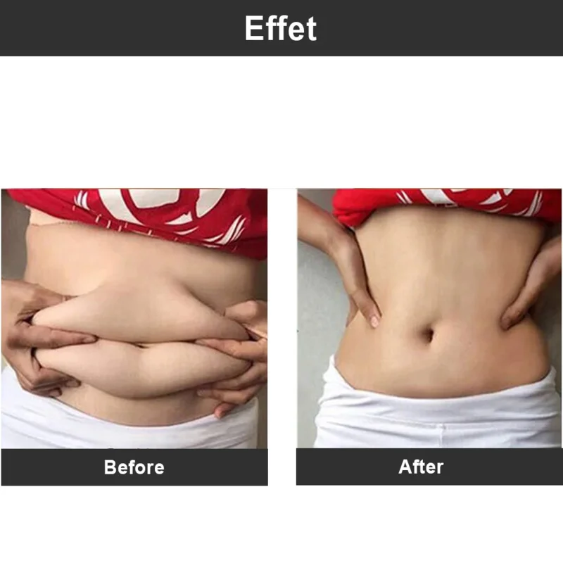 Биоэлектрическая стимуляция аппарат для подтяжки кожи лица холодный и Горячий