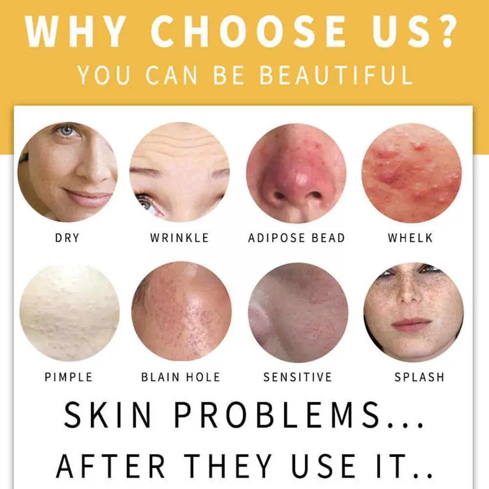 100 г куркума мыло Chniese травяное очищающее лечение акне питательное Отбеливающее