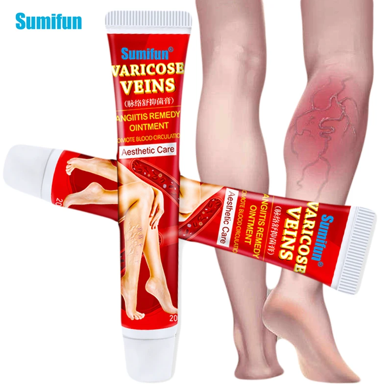 

2pcs Varicose Veins Treatment Cream Original Veins Smoke Balm Vasculitis Phlebitis Spider Pain Relief Ointment Medical Plaster