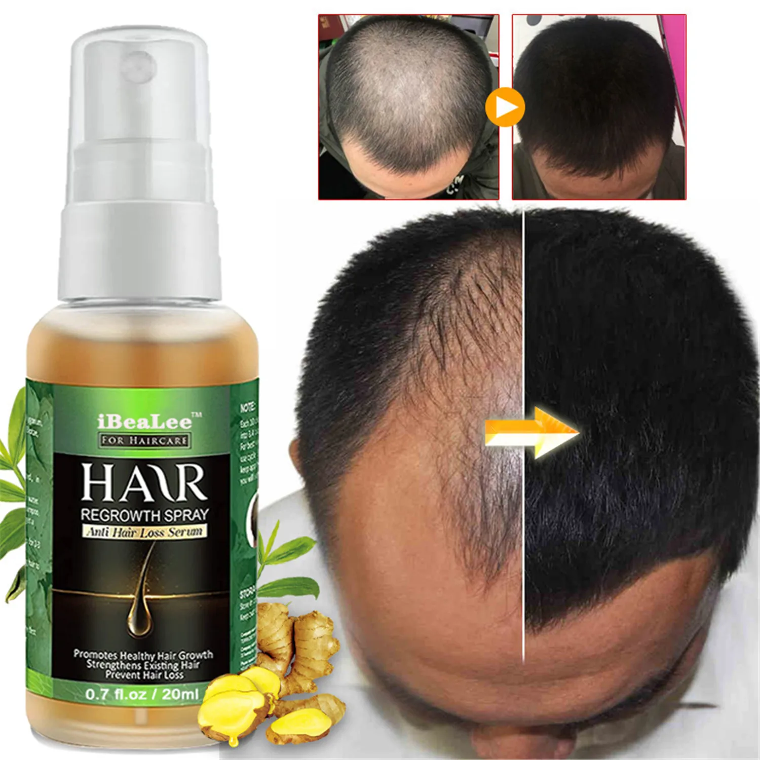 

Hair Growth Essential Oil Hair Treatment Spray Anti Hair Loss Product Ginger 7 Day Fast Grow Nourish Root Scalp Care Serum 20ml