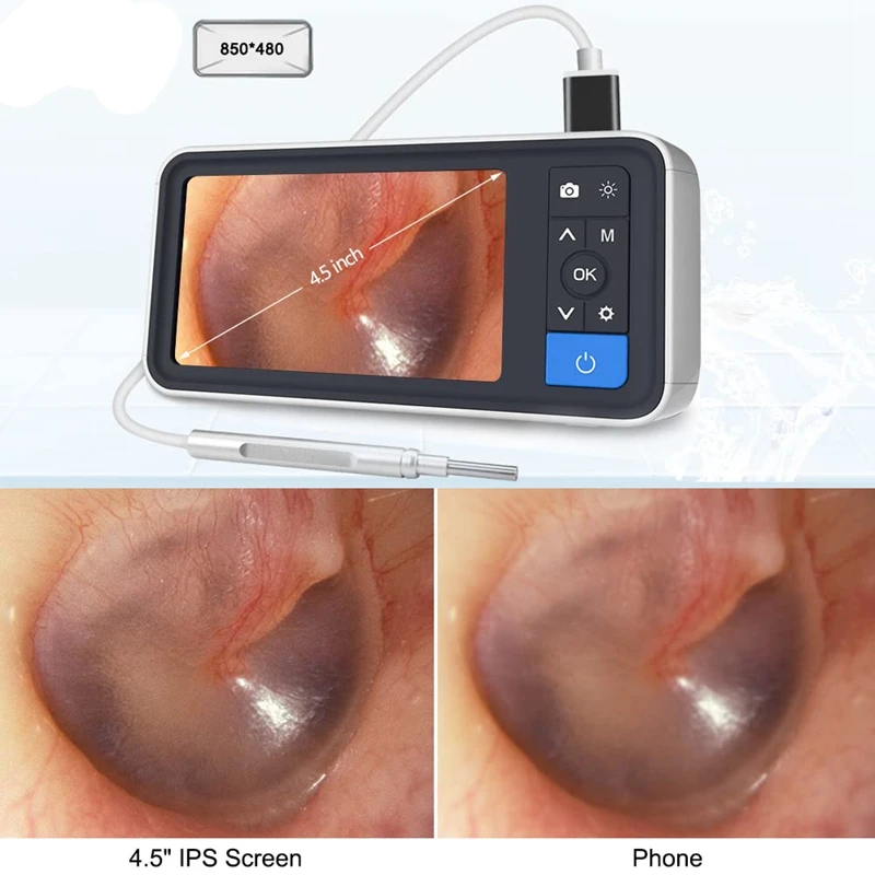 Otoscope With Light, 4.5Inch IPS Digital Video Otoscope, 3.9Mm Ear Camera With 6 Dimmable LED, Ear Wax Removal Camera