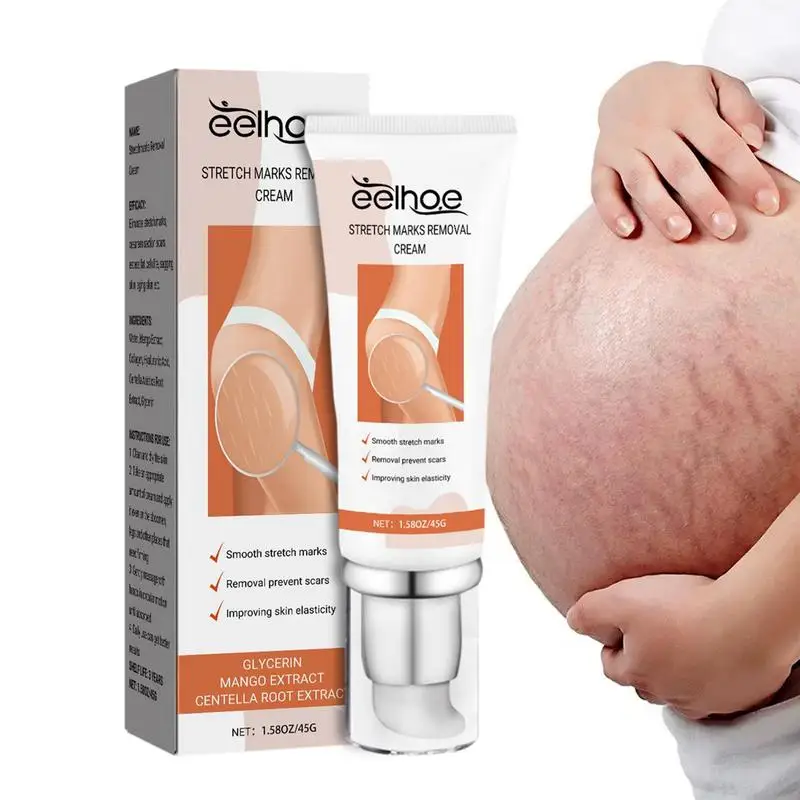 

Stretch Mark Cream Repairing Smoothing Rejuvenating Scar Removal Gel Plant Essences Scar Cream Nourishing Moisturizing Pregnancy