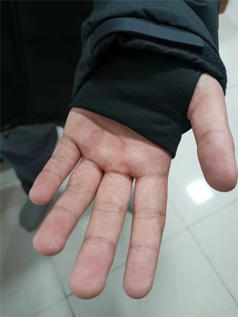 thumb
