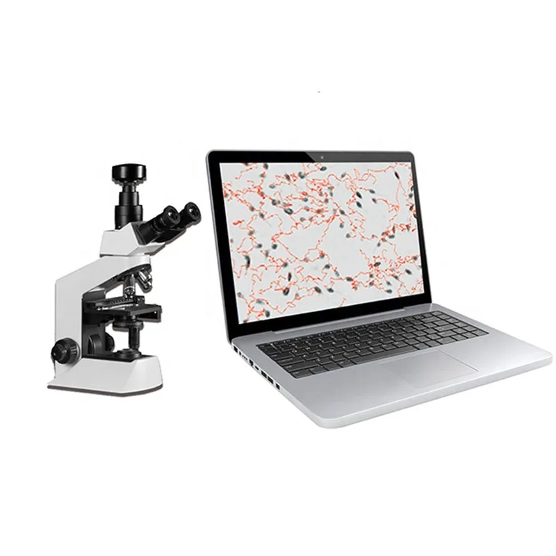Портативный автоматический анализатор качества спермы для тестирования мужской