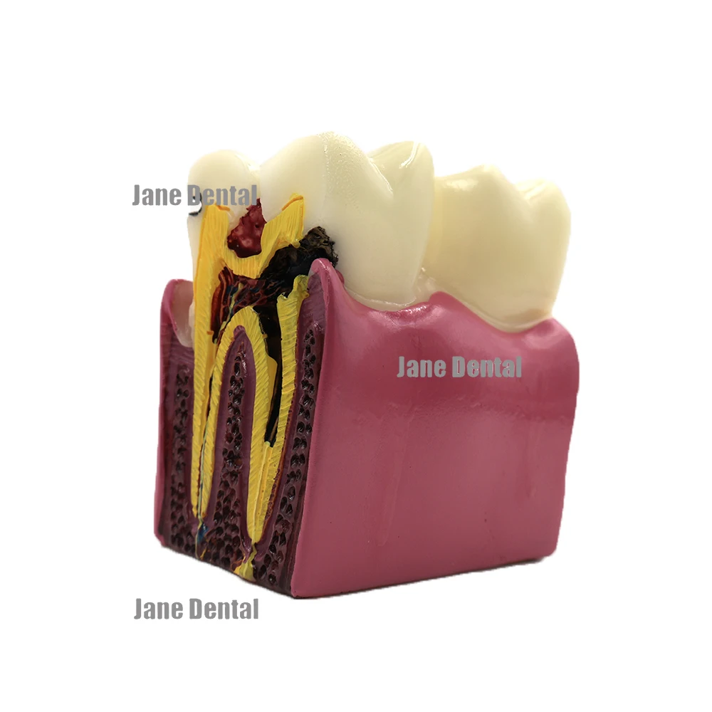 

Стоматологическая Анатомия Молярная Модель Анатомия сравнительные модели для обучения стоматолога