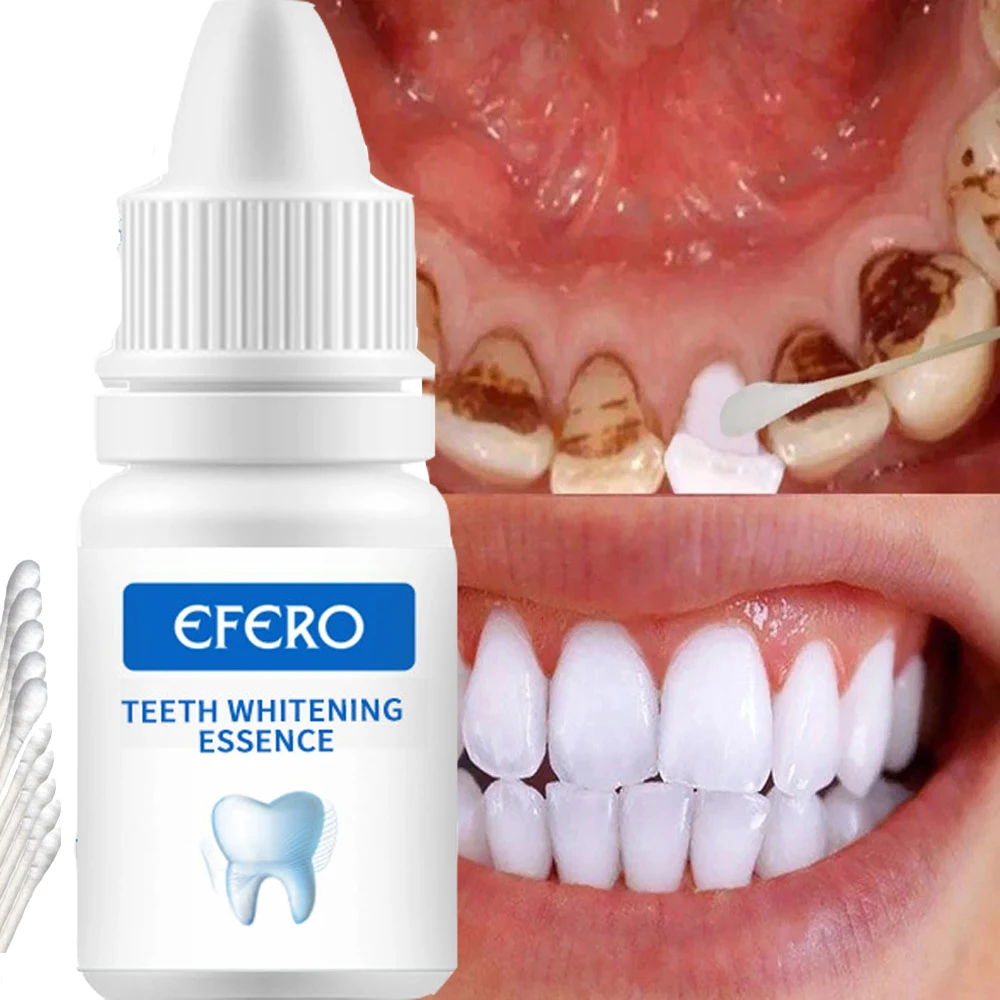 Teeth Whitening Serum Effective Remove Stains Plaque Deep Cleansing Dental Oral Hygiene Gel Teeth Whitening Kit Beauty Health