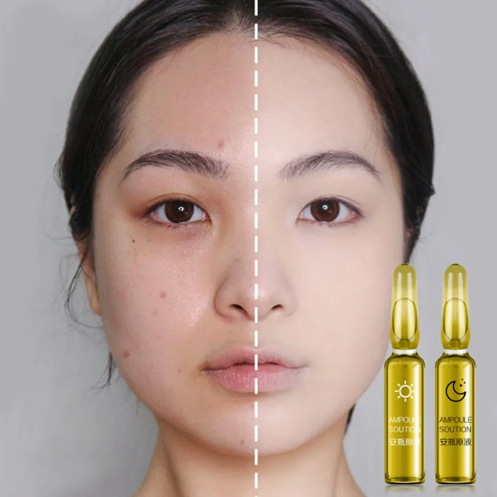 

Oligopeptide Ampoule Serum 28Pcs Moisturizing Nourishing Acne-treatment Repairing Remove Acne Marks Facial Essence Skin Care Set
