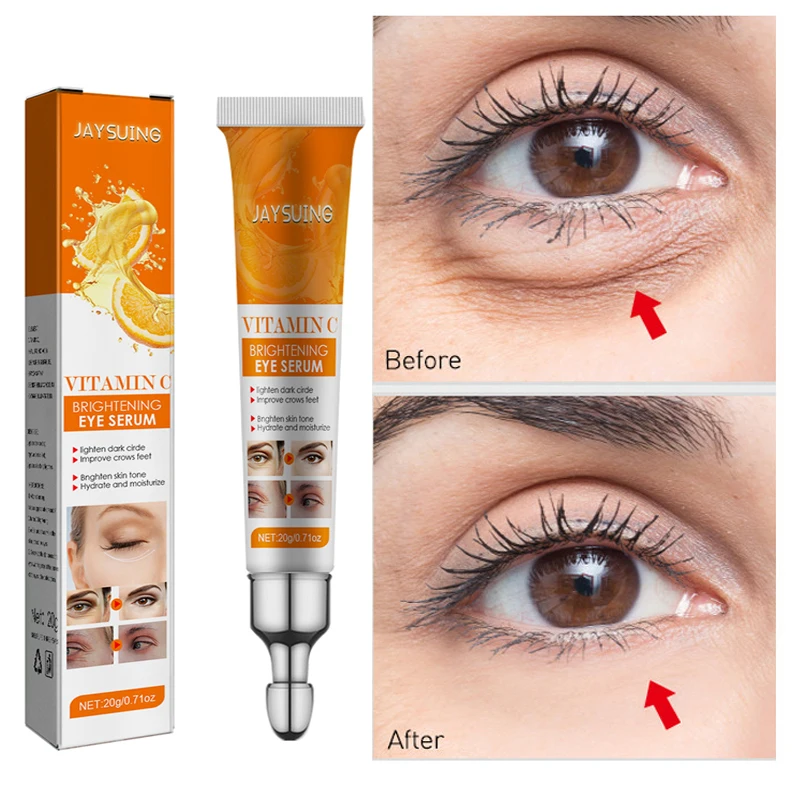 Eye Bags Removal Cream Anti Dark Circle Puffiness Skin Tighten Serum Anti-wrinkle Fade Fine Lines Vitamin C Whitening Skin Care