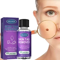 removing against moles liquid papillomas removal of warts liquid from skin tags remover anti verruca remedy