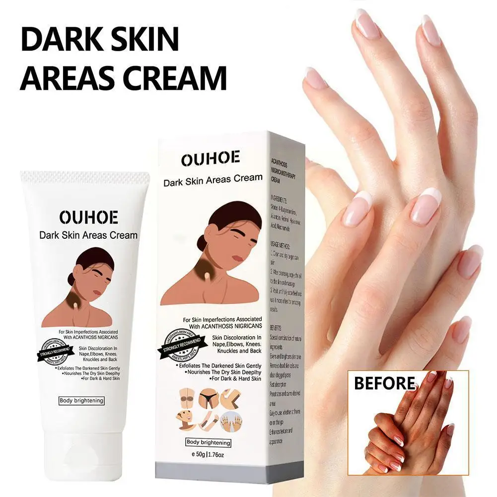 

Whitening Cream For Intimate Area Dark Skin Underarm Neck Inner Elbow Remove Armpit Knees Black Spots Bleach Hot I0O6