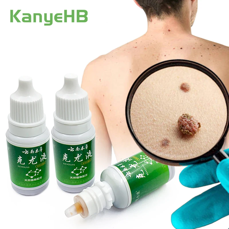 

3pcs Wart Removal Liquid Callosity Wart Remover Herbal Extracts Remove Warts Moles Papilloma Painless Without Leave Scars A1089