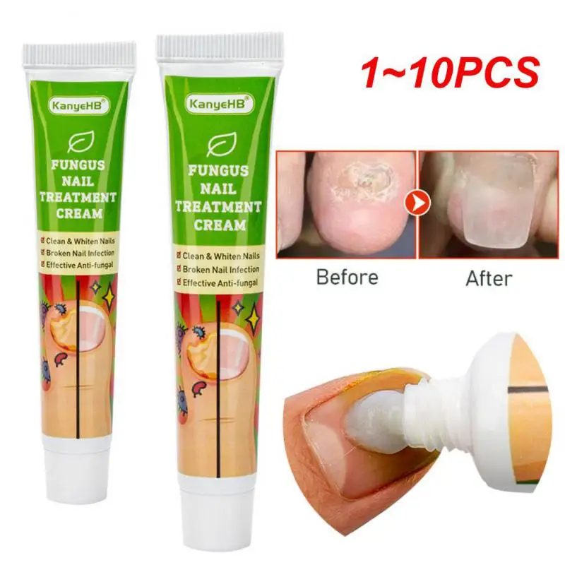 

1-10 шт., отбеливающий крем для ногтей, 20 г