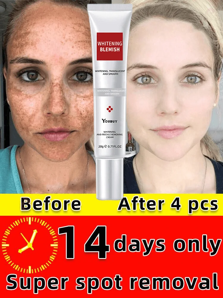 

Whitening Freckle Cream Effective Remove Melasma Serum Fade Dark Spots Melanin Moisturize Brighten Smooth Face Skin Care Korean