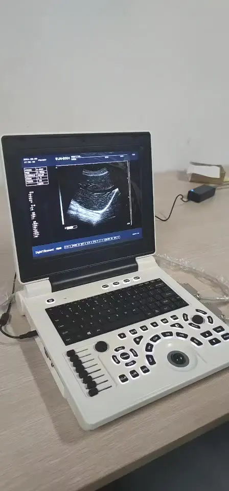 

CE Best price laptop 12.1 inches LED ultrasound machine price/Laptop Ultrasound scanner