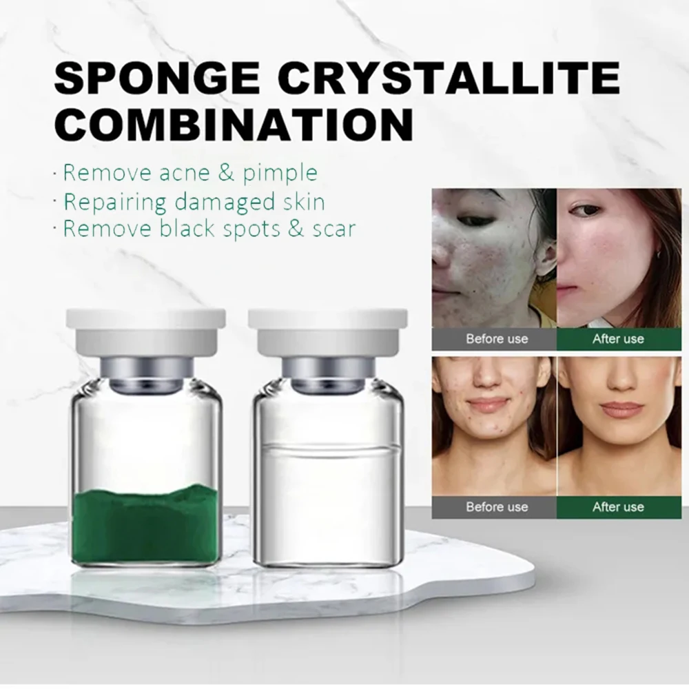 

2023 New Acne Algae Sponge Microneedles Scar Non-invasive No Needle Treatment Serum for Acne Dark Spots Removing Skin Rejuvenat