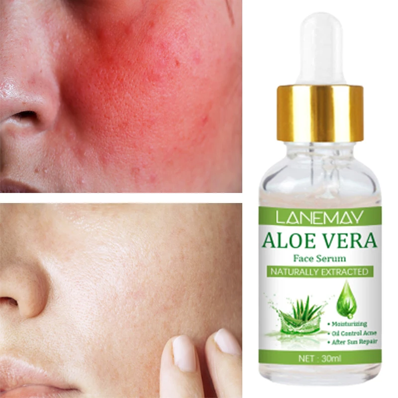 Aloe Vera Oil Free Serum Repair Sunburn Redness Acne Skin Collagen Face Serum Inhibit Melanin Hydrating Anti-Aging Beauty Care