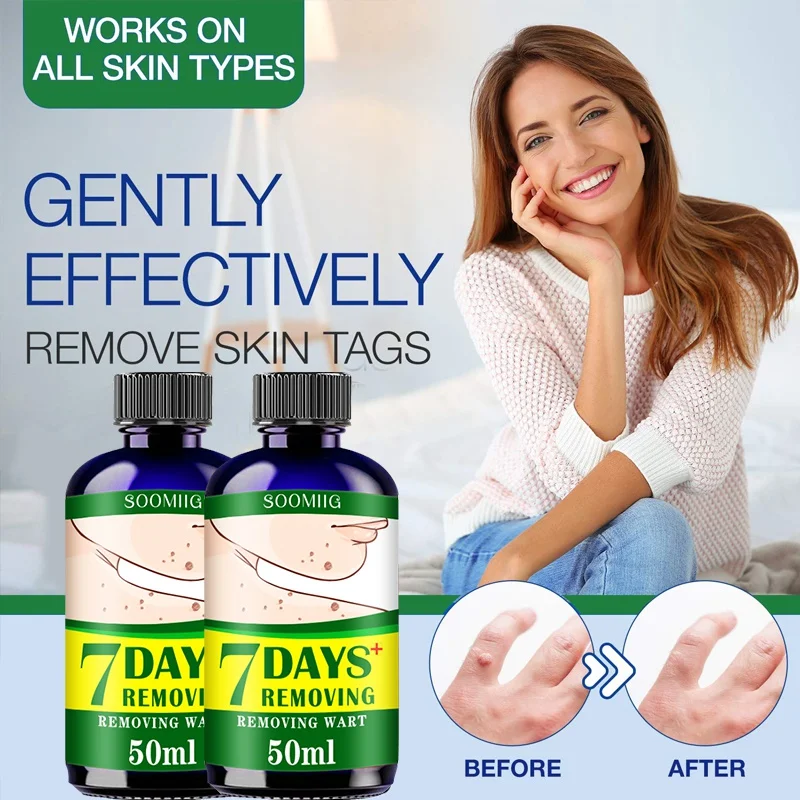 

Warts Remover Antibacterial Ointment Wart Treatment Cream Skin Tag Remover Herbal Extract Corn Plaster Warts Ointment