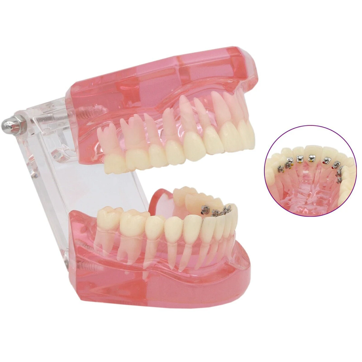 

Dental Orthodontic Teeth Model With Lingual Braces Tube Acrylic Pink Dental Classroom Teaching Display Teeth Model