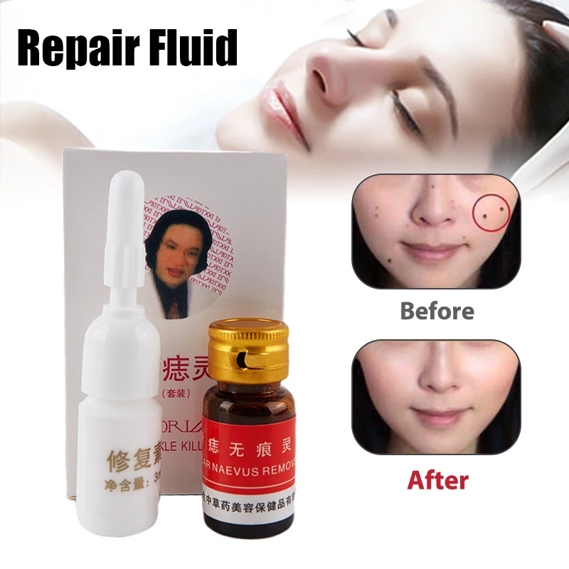 

Mole & Skin Tag Removal Solution Painless Mole Skin Dark Spot Removal Face Wart Tag Freckle Removal Cream Oil Plaster