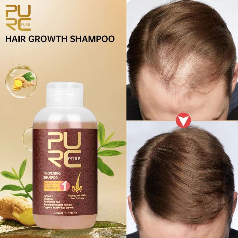 

PURC Ginseng Ginger Hair Growth Shampoo and Conditioner Anti Hair Loss Anti-Dandruff Scalp Treatment Smoothing Hair Care