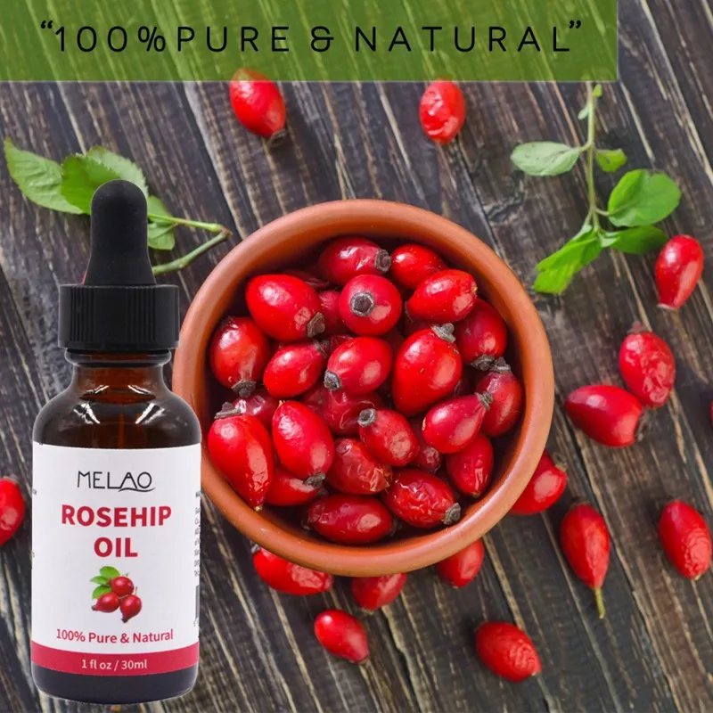 Эфирное масло чистого имбиря для массажа кожи тела 30 мл предотвращает выпадение