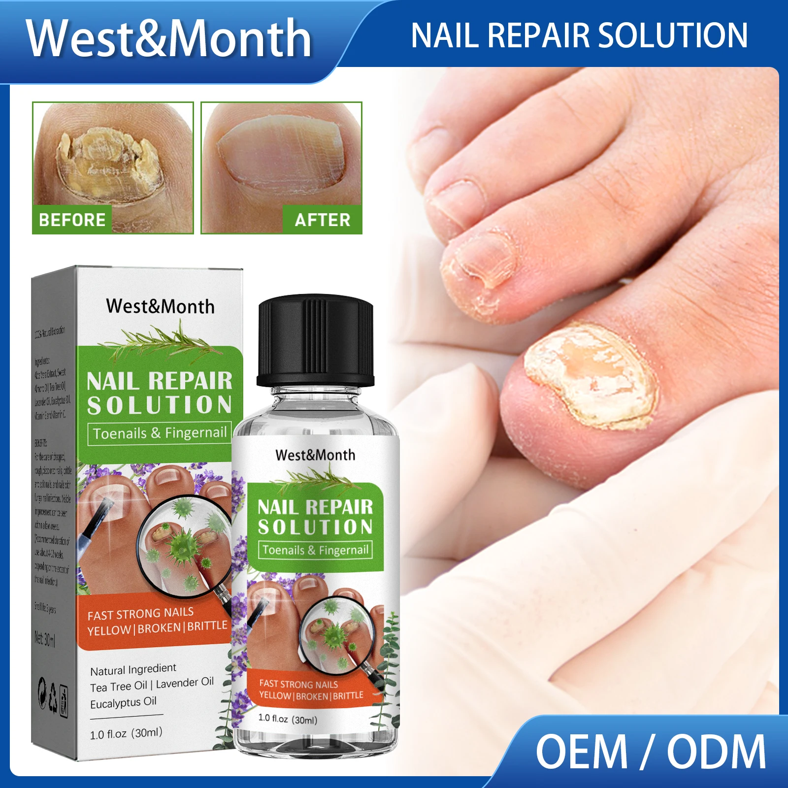 

Восстанавливающий лосьон с маслом из чайного дерева для ногтей, утолщение, онихомикоз с вросшими и вросшими ногтями, мягкий раствор для восстановления ногтей, 30 мл