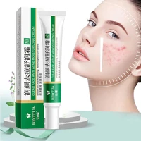 effective acne removal cream acne treatment fade acne spots oil control shrink pores whitening moisturizing acne cream skin care