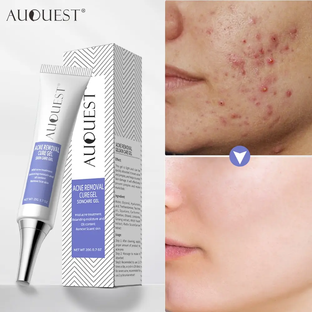 

AuQuest Herbal Acne Removal Face Gel Cream Anti-ance Remove Pimple Skin Repair Cream Acne Scar Removal Acne Treatment Skin Care