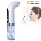 Устройство для удаления черных точек на лице DIOZO