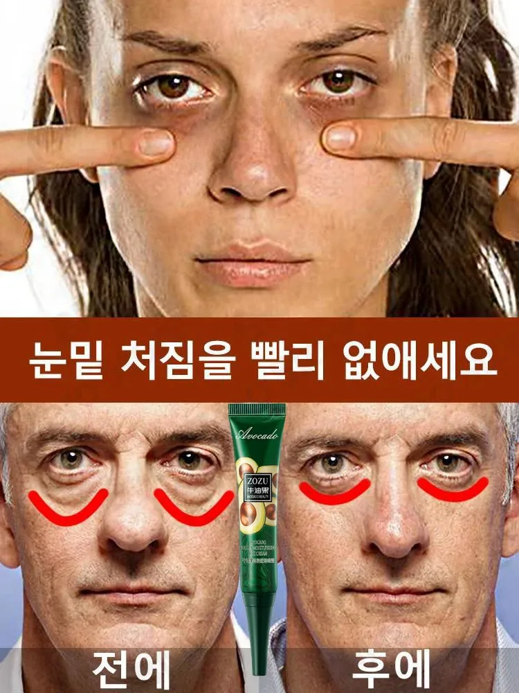 Крем для кожи вокруг глаз от Тёмных кругов мешков и припухлостей