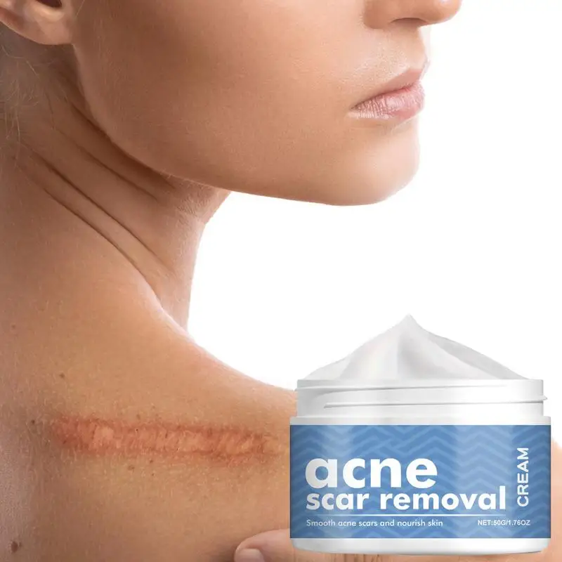 Крем для лица удаления прыщей гель против лечение шрамов от сужение пор