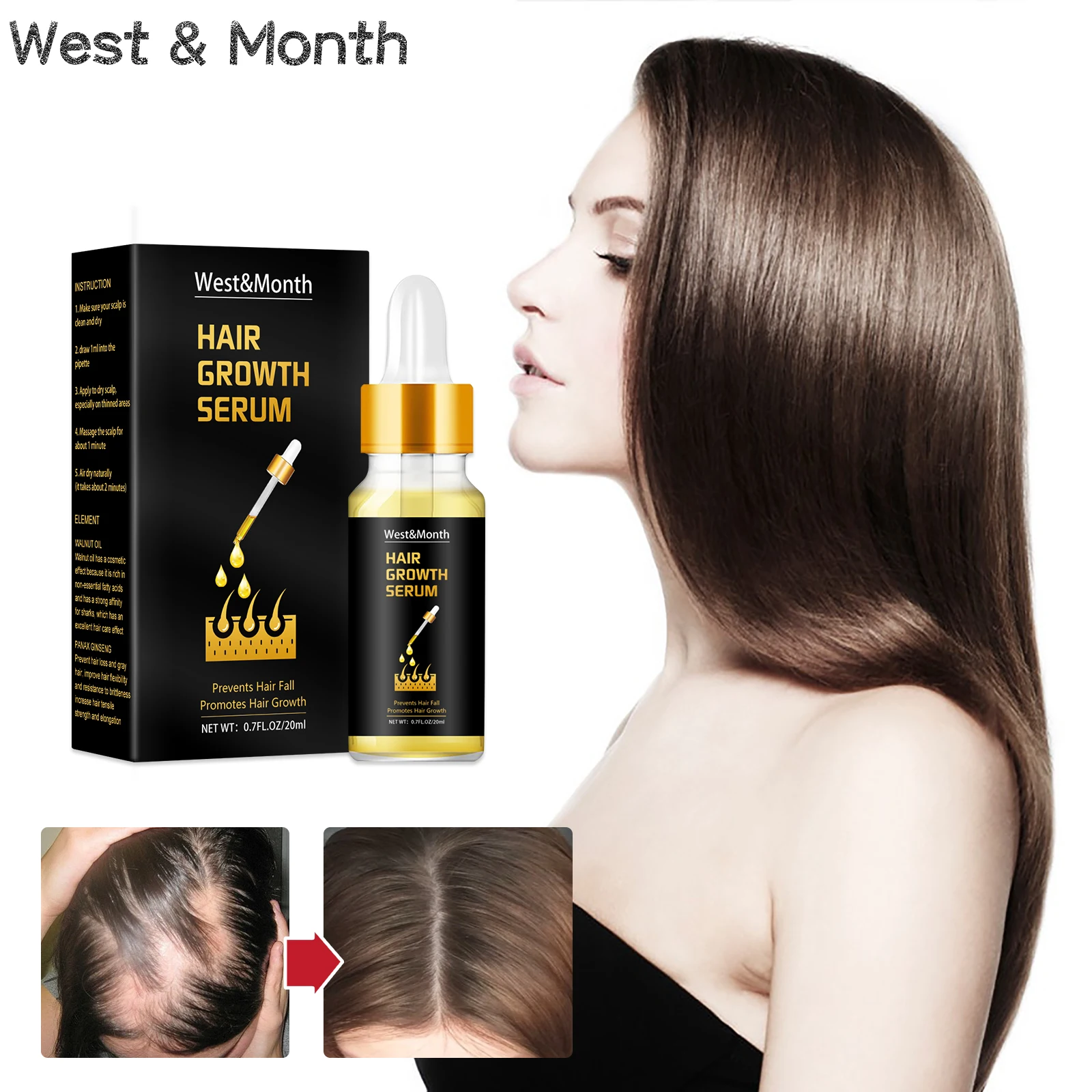 

Hair Growth Serum Products Anti Hair Loss Fast Growing Germinal Essence Nourishing Scalp Prevent Scalp Damaged For Men Women
