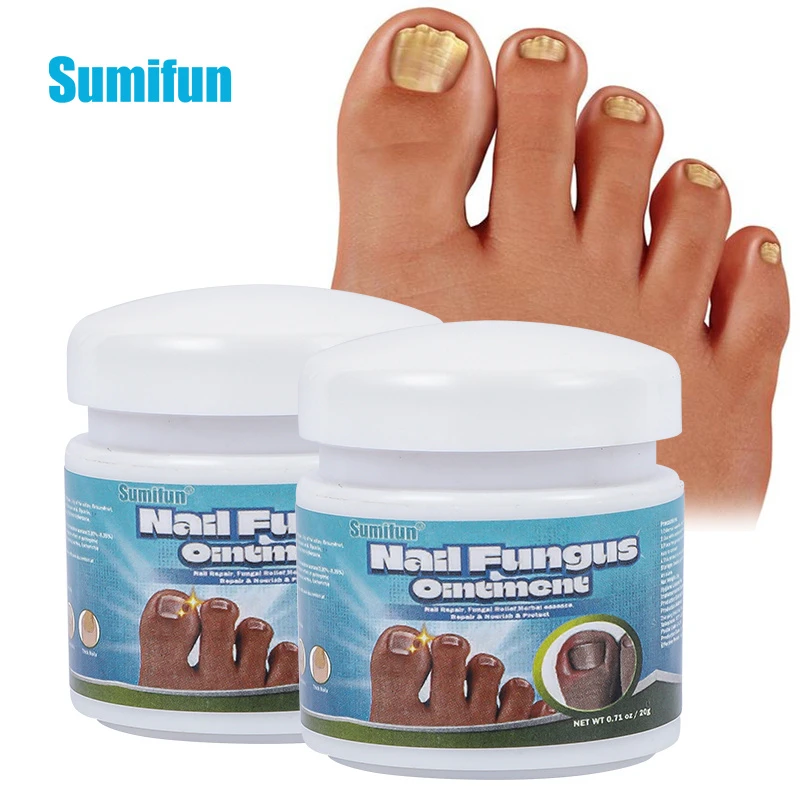 

20g Sumifun Nail Fungal Treatment Feet Care Cream Anti Infection Paronychia Onychomycosis Nail Foot Toe Fungus Removal Ointment