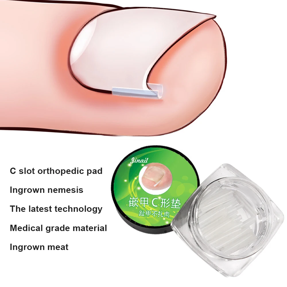 

10pcs Ingrown Nail Pad Toenail Correction Tool Ingrown Toe Nail Care Elastic Patch Straightening Clip Brace Pedicure Tool