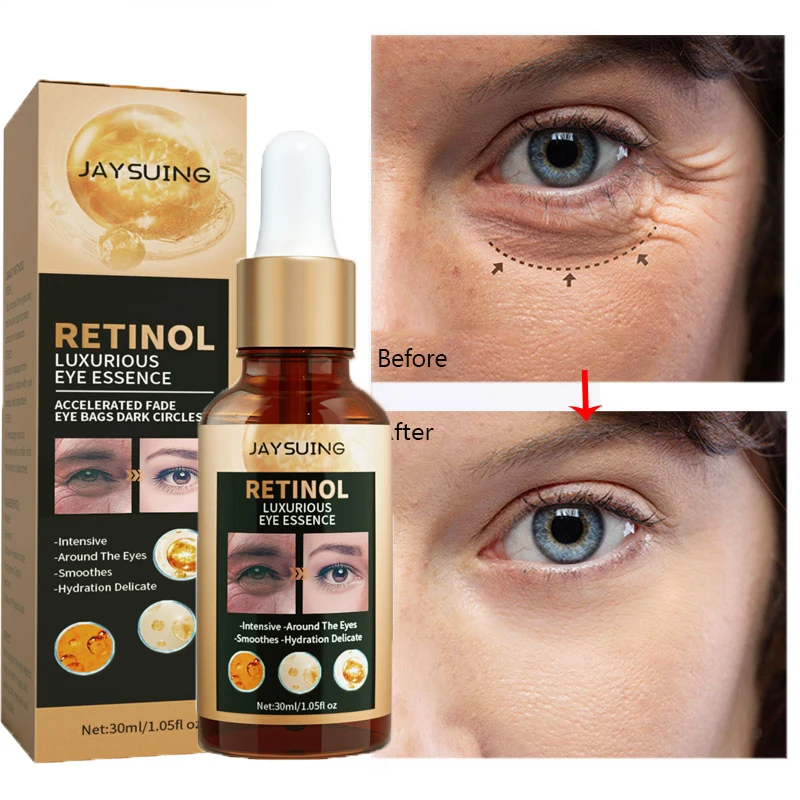Retinol Anti-Wrinkle Eye Serum Fades Fine Lines Anti Dark Circles Essence Remove Eye Bags Puffiness Anti-Aging Smooth Eye Care