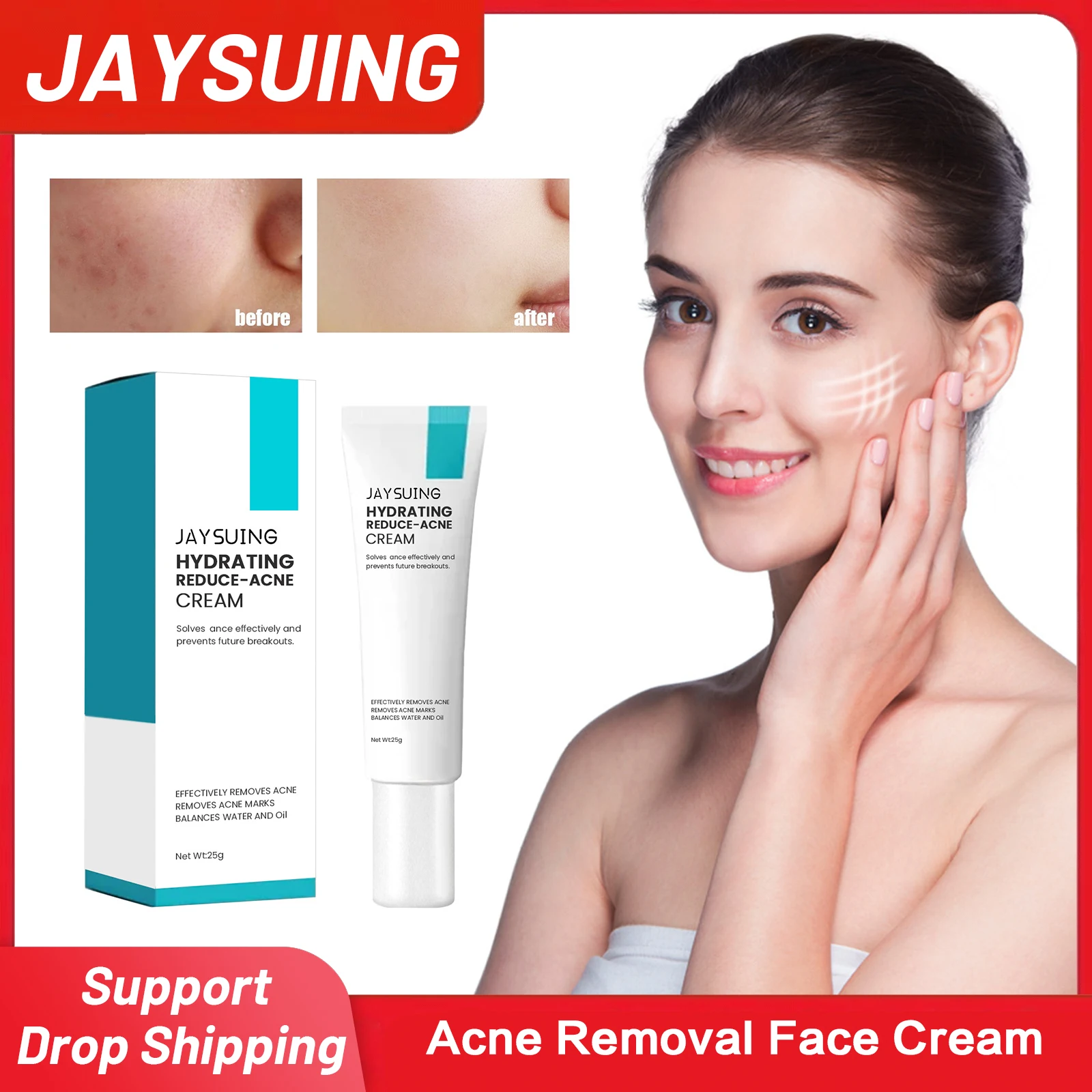 

Acne Removal Face Cream Oil Control Eliminate Pimples Shrink Pores Anti Inflammatory Whitening Moisturizing Anti Acne Cream 25g