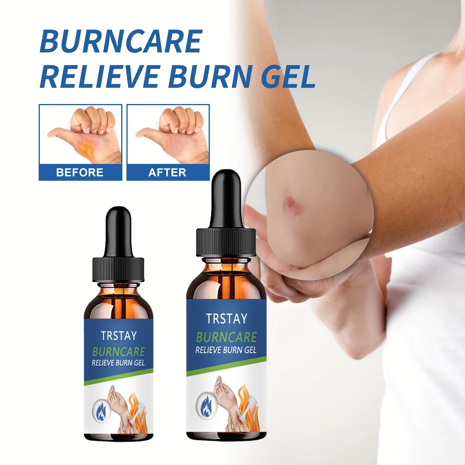 Снимает ожоги гель от красноты лица