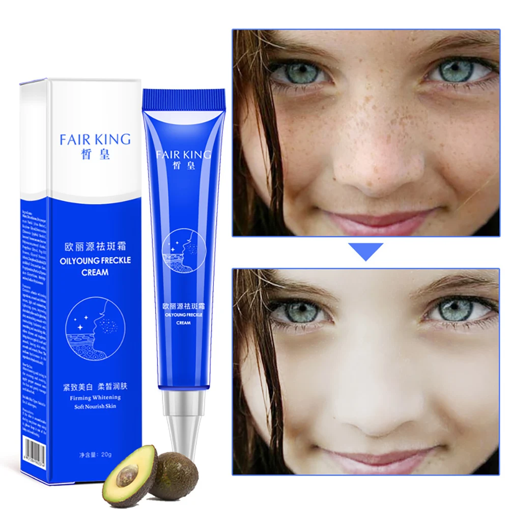 

Fair King 20g Strong Effects Powerful Whitening Freckle Cream Remove Melasma Acne Spots Pigment Melanin Face Care