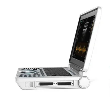 Медицинская кардиология портативный 12-дюймовый ультразвуковой аппарат цифровой