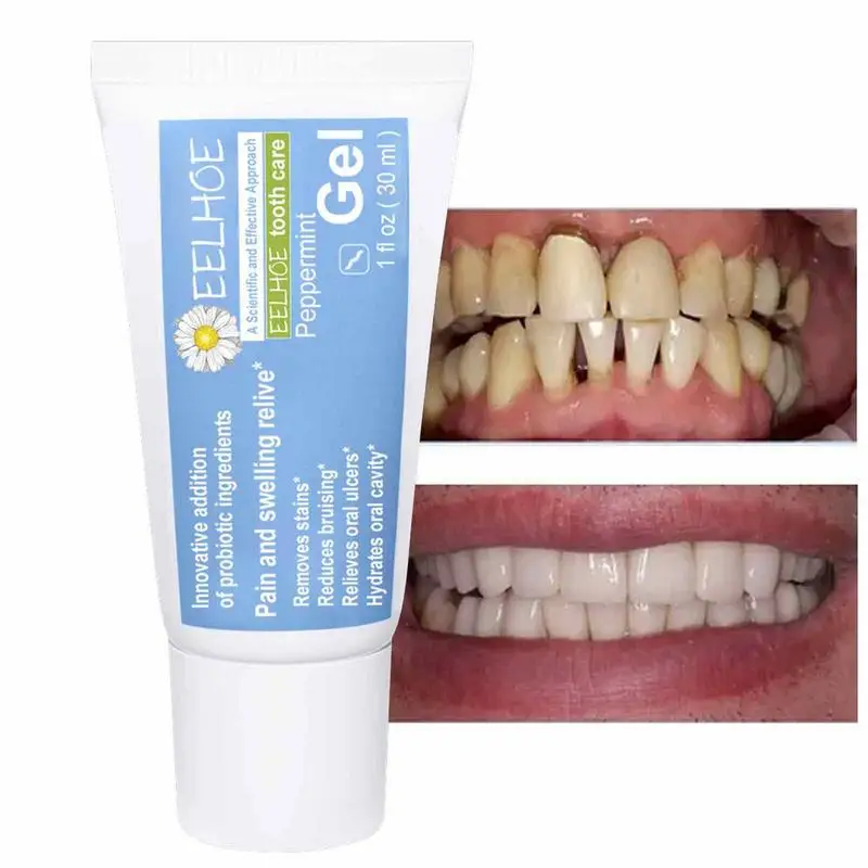 

30ml Probiotic Teeth Whitenings Mousse Deep Cleaning Stains Repair Bright Neutralizes Yellow Tone Dentals Care Freshening Breath