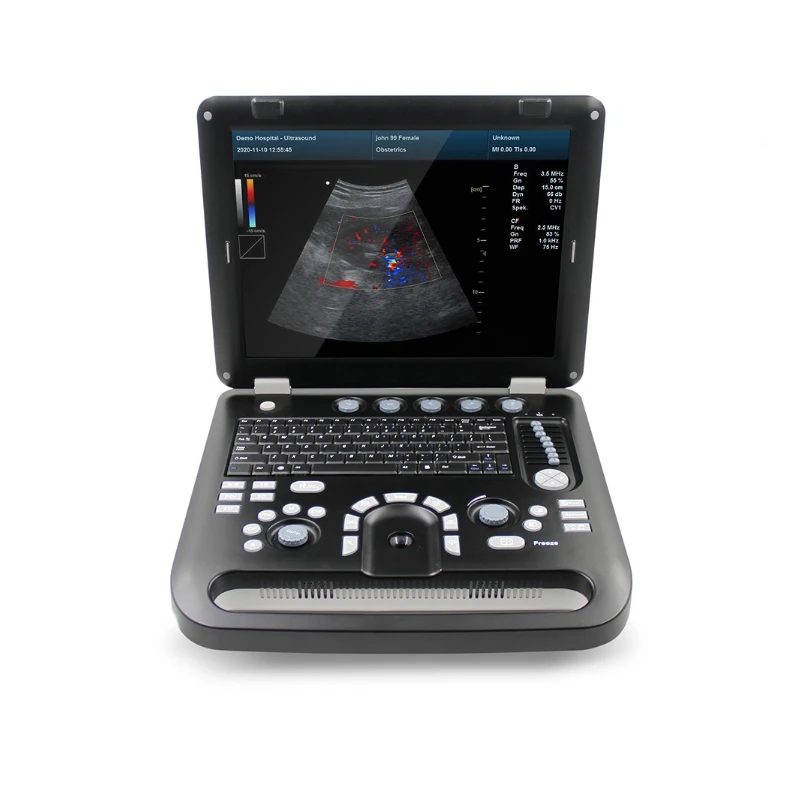 1700B 4D Color Doppler USG Color Cardiac Ultrasound Scanner Diagnostic Machine Systems Micro Convex Probe