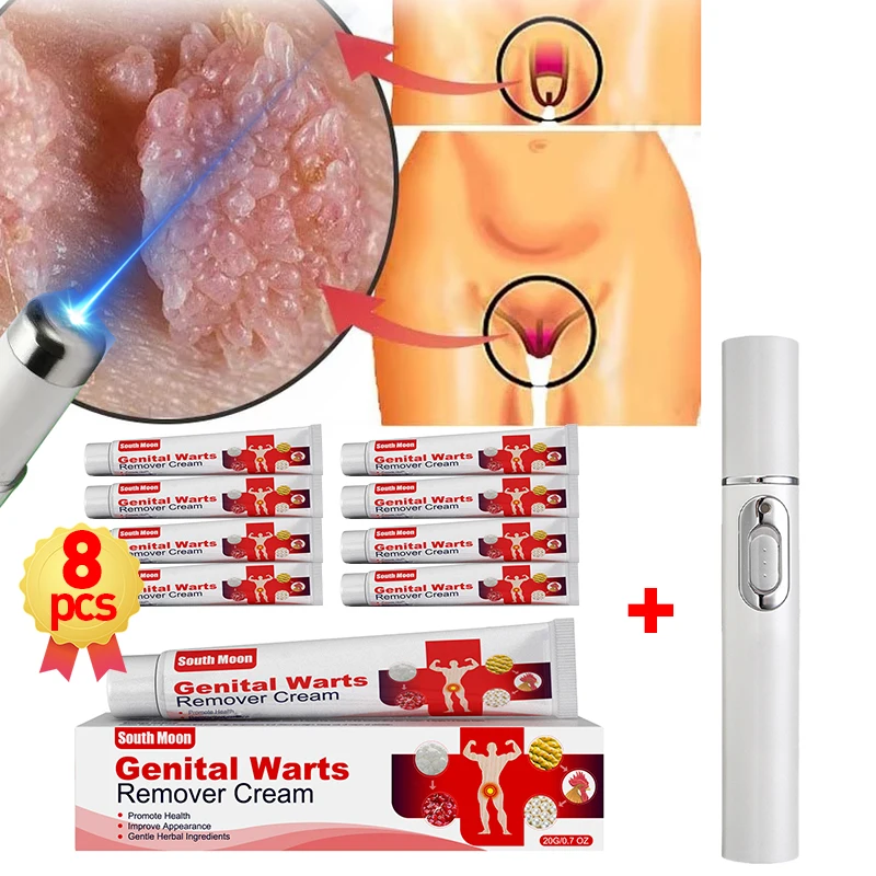 Лазерная ручка для удаления генитальных бородавок гениталии кондиломы мужчин и