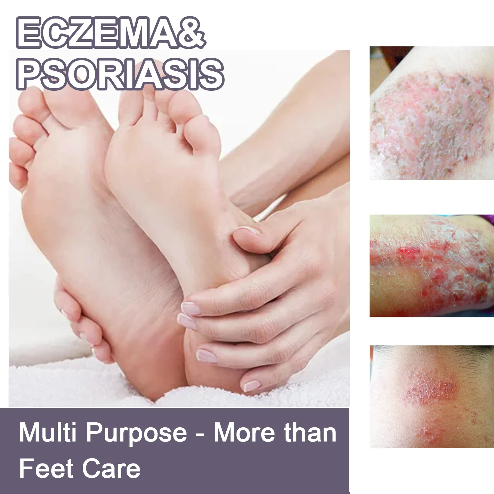 Рисунок 4 - Спрей для лечения псориаза