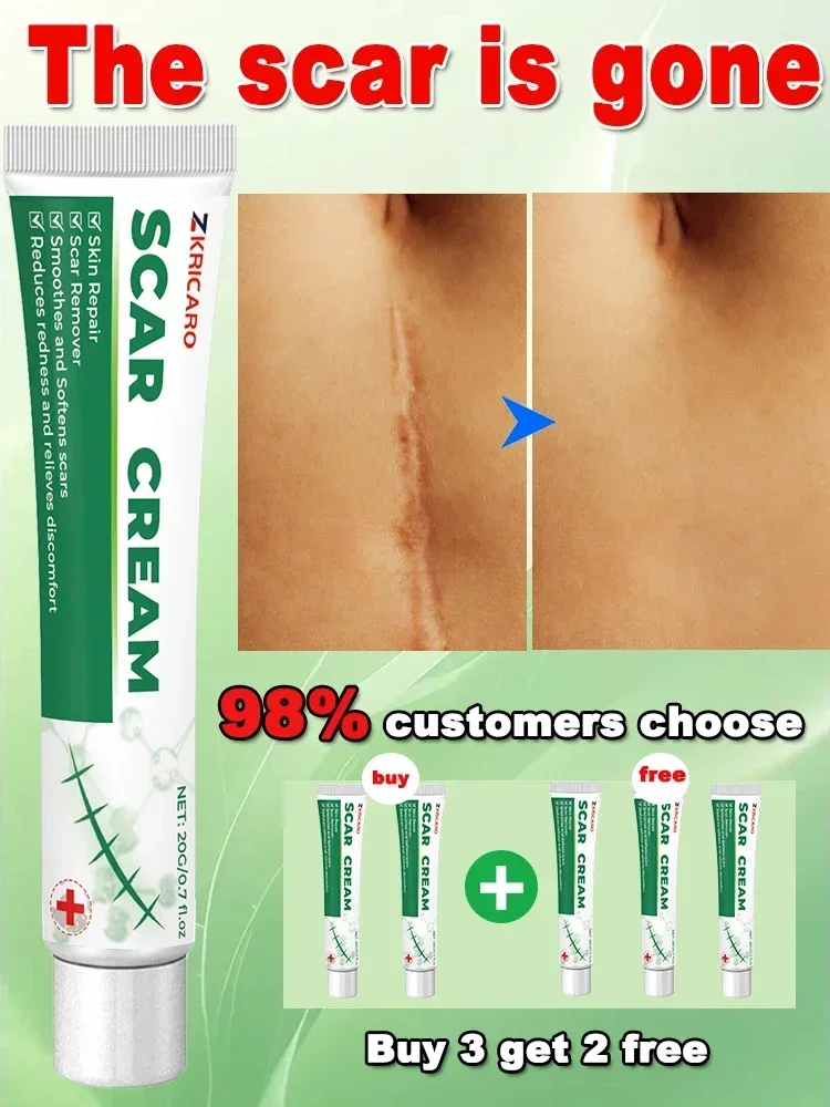 Шрамы самый продаваемый новый продукт постоянный ремонт