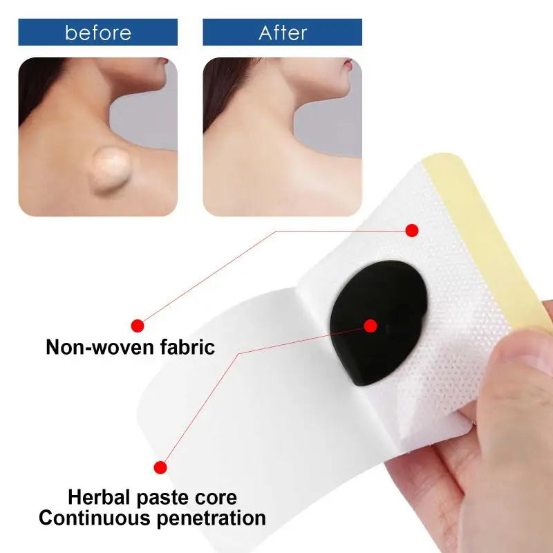 

12pcs Subcutaneous Lump Care Patch Fat Knot Repair Patch Soothing Body Multiple Fat Knot Digestion Skin Care Treatment