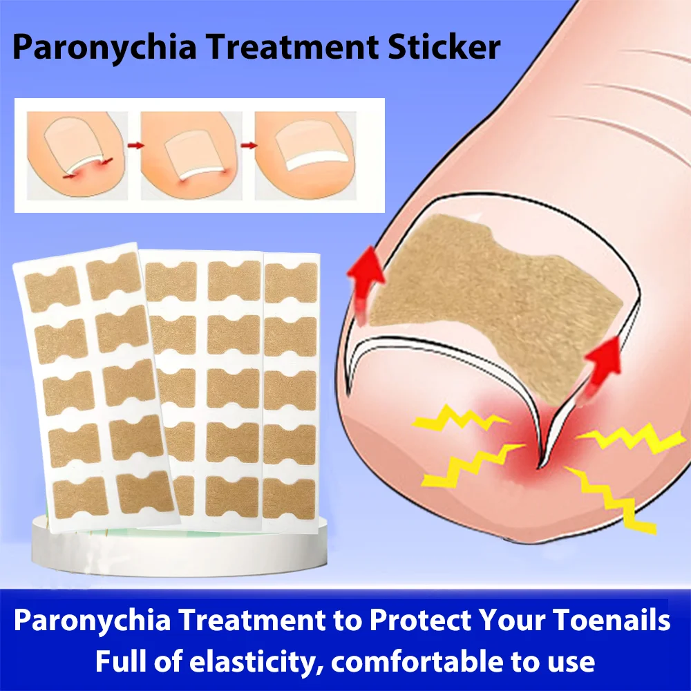 Ifory 100 шт. рельефный пластырь для паронихии корректор ногтей полоски лечения