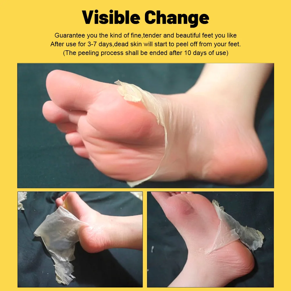 Отшелушивающая маска для ног удаления омертвевшей кожи инструмент ухода за