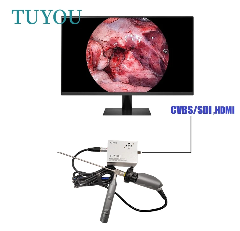 

Full HD Portable ENT Endoscopy System Medical endoscop camer for Laptop Computer