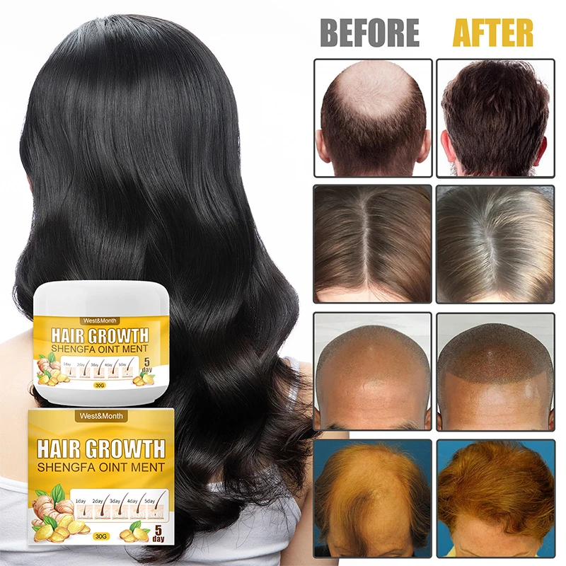 

Hair Loss Hair Growth Cream Moisturizing Scalp Massage Hair Care Essence Hair Care Essence Conditioner